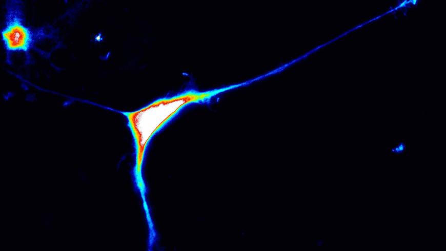 UN NUOVO GENE RESPONSABILE DELL’AUTISMO